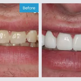 Smile More! Our custom planned individual care is the standard you have been looking for.