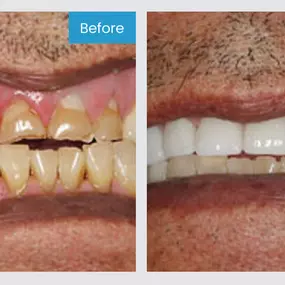 Smile More! Our custom planned individual care is the standard you have been looking for.