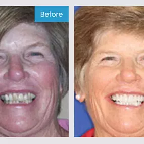 Smile More! Our custom planned individual care is the standard you have been looking for.