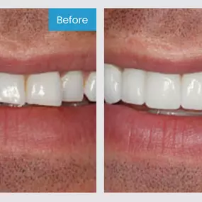 Smile More! Our custom planned individual care is the standard you have been looking for.