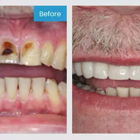 Smile More! Our custom planned individual care is the standard you have been looking for.