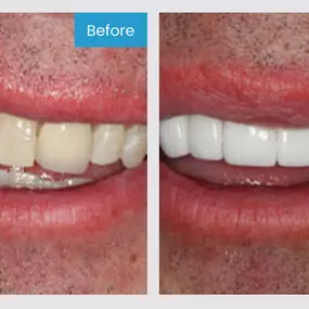 Smile More! Our custom planned individual care is the standard you have been looking for.