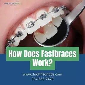 Dentist in Fort Lauderdale - Fast Braces