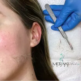 Bild von Meraki Skin & Laser Studio