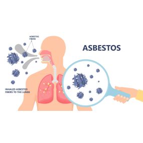 Asbestos Risk Assessments