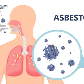 Asbestos Risk Assessments