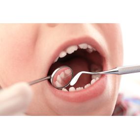 Pediatric Dental Care Checkup from Schweppe Pediatric Dentistry in Ogden, UT