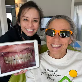 Invisalign at Mint Dental Loft Pasadena CA