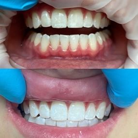 Bild von Central Avenue Dentistry