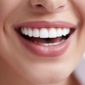 Teeth whitening is a safe and non-invasive treatment with long-lasting results. As we all age, our teeth begin to yellow. Avoiding certain foods can help reduce this effect, but this only works as a preventative measure.