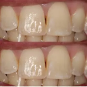 Bild von Central Avenue Dentistry