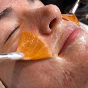 Oxygen Facial