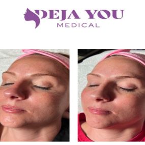 Bild von Deja You Medical | Aesthetics and Wellness