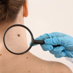 Mole Removal in New Jersey