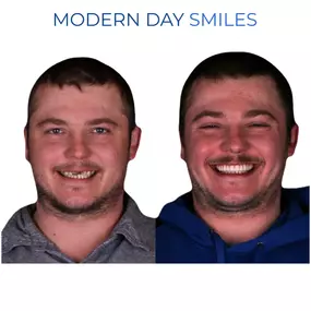 Modern dental techniques for a natural smile