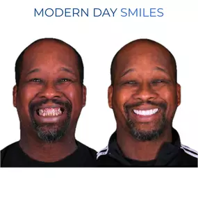 Smile improvement through precision dentistry