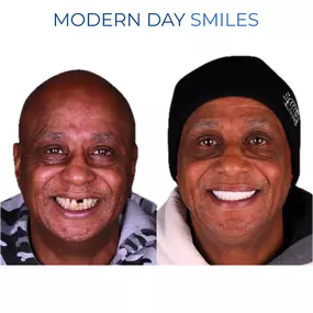 Whiter and more symmetrical smile design