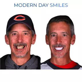 Enhanced smile aesthetics with advanced materials