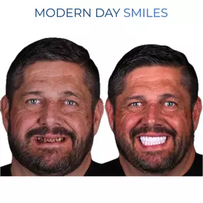 Confident smile achieved with personalized treatment