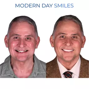 Restorative treatment producing a natural finish