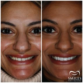 Bild von Promenade Smiles Family Dentistry Implant, Oral Surgery, and Cosmetic Dentist