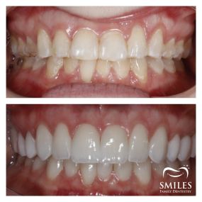 Bild von Promenade Smiles Family Dentistry Implant, Oral Surgery, and Cosmetic Dentist