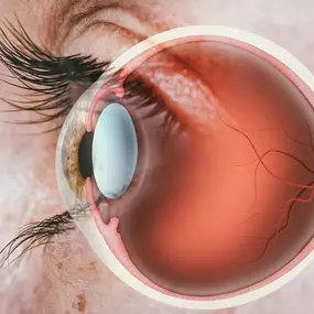 Anatomy of an Eye