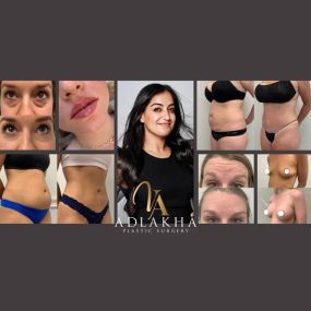 Bild von Adlakha Plastic Surgery