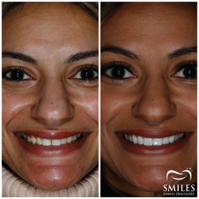 Bild von Mercer Smiles Family Dentistry Implant, Oral Surgery, and Cosmetic Dentist