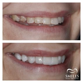 Bild von Mercer Smiles Family Dentistry Implant, Oral Surgery, and Cosmetic Dentist