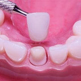 Bild von Neric Médecine dentaire I Zahnmedizin