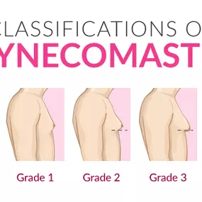 Gynecomastia surgery can restore your confidence, making it a worthwhile surgery with impressive results.

Rest assured, Dr. Mazaheri aims to provide a rewarding experience in the process he takes you through, as well as achieving your desired results.