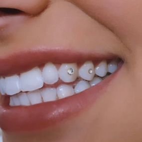 Bild von Personal Dental