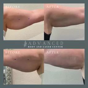 Bild von Advanced Body and Laser Center l Medical Spa