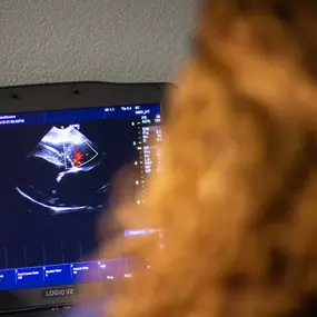 An echocardiogram is an ultrasound image of the heart and associated large blood vessels.