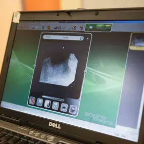 Digital radiography is just one of the many state-of-the art tools that we use here at Skippack Animal Hospital to make sure your pet gets the best care possible.