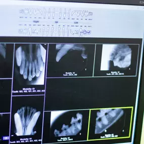 We maintain a digital dental xray in order to accurately diagnose your pet’s condition, and perform cleanings under the gum line (where periodontal disease lurks), along with procedures that are needed when the disease is more advanced, such as extractions.