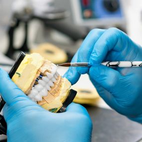 Vision Dental Studio Inc - Serving our Dental Community for Over 40 Years. Our longevity based on investing in the latest dental technology and techniques to deliver prosthetics that are both functional and aesthetically pleasing.