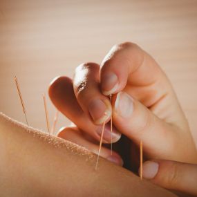 Bild von Ombright Wellness Acupuncture Holistic Center and Mobile Acupuncture Therapy