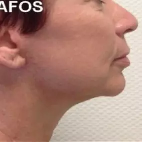 Bild von Dr Eric BONAFOS Chirurgien Esthétique Montpellier Chirurgie de la face et du cou