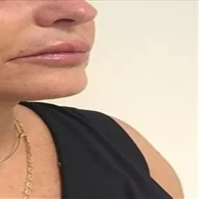 Bild von Dr Eric BONAFOS Chirurgien Esthétique Montpellier Chirurgie de la face et du cou