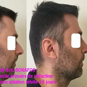 Bild von Dr Eric BONAFOS Chirurgien Esthétique Montpellier Chirurgie de la face et du cou