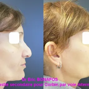 Bild von Dr Eric BONAFOS Chirurgien Esthétique Montpellier Chirurgie de la face et du cou