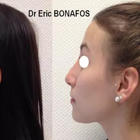 Bild von Dr Eric BONAFOS Chirurgien Esthétique Montpellier Chirurgie de la face et du cou