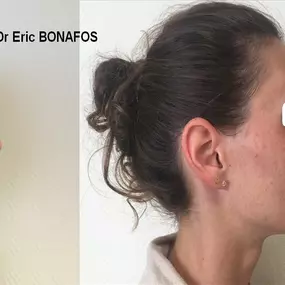 Bild von Dr Eric BONAFOS Chirurgien Esthétique Montpellier Chirurgie de la face et du cou