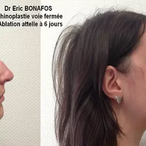 Bild von Dr Eric BONAFOS Chirurgien Esthétique Montpellier Chirurgie de la face et du cou