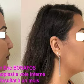 Bild von Dr Eric BONAFOS Chirurgien Esthétique Montpellier Chirurgie de la face et du cou