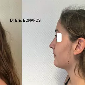 Bild von Dr Eric BONAFOS Chirurgien Esthétique Montpellier Chirurgie de la face et du cou