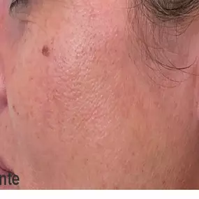 Bild von Dr Eric BONAFOS Chirurgien Esthétique Montpellier Chirurgie de la face et du cou