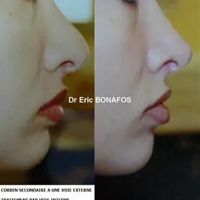 Bild von Dr Eric BONAFOS Chirurgien Esthétique Montpellier Chirurgie de la face et du cou